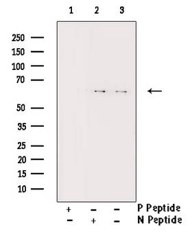 CHEK2 / CHK2 Antibody - Western blot analysis of Chk2 phosphorylation expression in UV treated 293 whole cells lysates. The lane on the right is treated with the antigen-specific peptide.