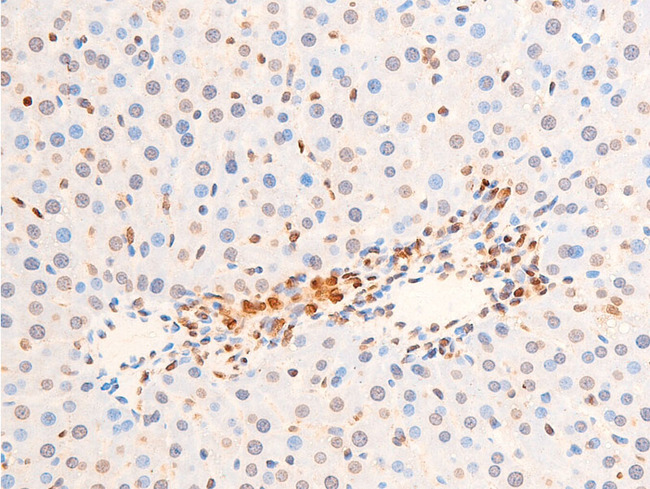 CHEK2 / CHK2 Antibody - 1:100 staining rat liver tissue by IHC-P. The tissue was formaldehyde fixed and a heat mediated antigen retrieval step in citrate buffer was performed. The tissue was then blocked and incubated with the antibody for 1.5 hours at 22°C. An HRP conjugated goat anti-rabbit antibody was used as the secondary.