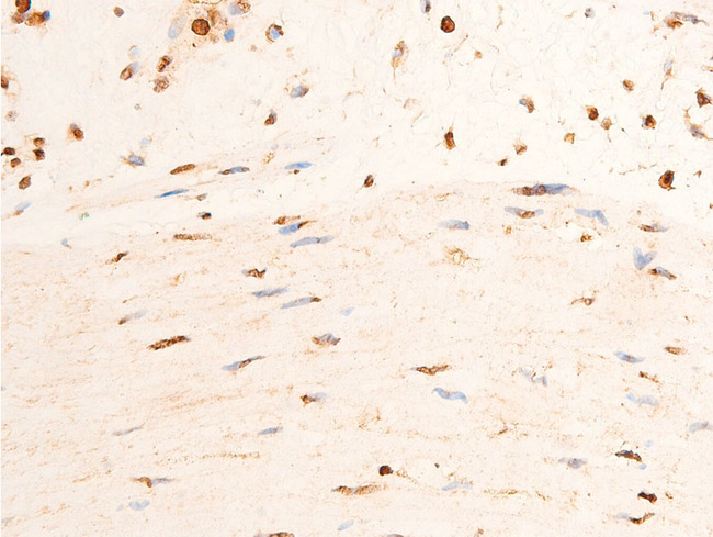 CHEK2 / CHK2 Antibody - 1:100 staining human gastric tissue by IHC-P. The tissue was formaldehyde fixed and a heat mediated antigen retrieval step in citrate buffer was performed. The tissue was then blocked and incubated with the antibody for 1.5 hours at 22°C. An HRP conjugated goat anti-rabbit antibody was used as the secondary.