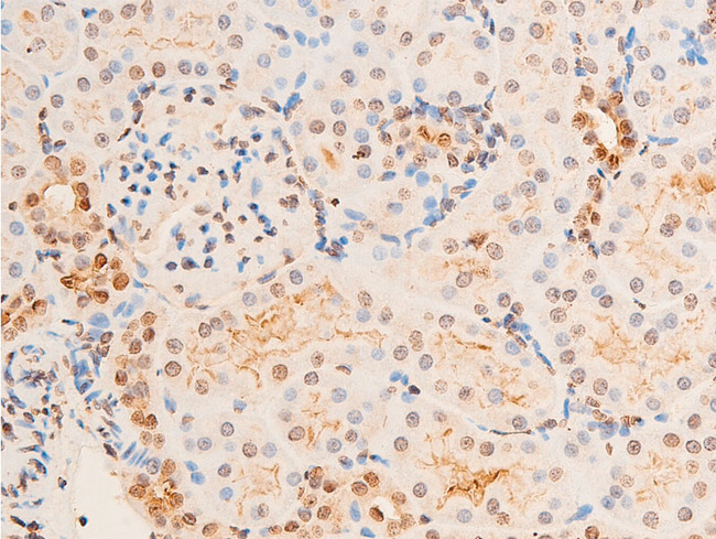 CHEK2 / CHK2 Antibody - 1:100 staining rat kidney tissue by IHC-P. The tissue was formaldehyde fixed and a heat mediated antigen retrieval step in citrate buffer was performed. The tissue was then blocked and incubated with the antibody for 1.5 hours at 22°C. An HRP conjugated goat anti-rabbit antibody was used as the secondary.