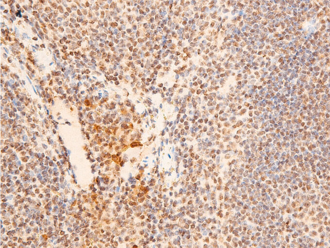 CHEK2 / CHK2 Antibody - 1:100 staining mouse spleen tissue by IHC-P. The tissue was formaldehyde fixed and a heat mediated antigen retrieval step in citrate buffer was performed. The tissue was then blocked and incubated with the antibody for 1.5 hours at 22°C. An HRP conjugated goat anti-rabbit antibody was used as the secondary.