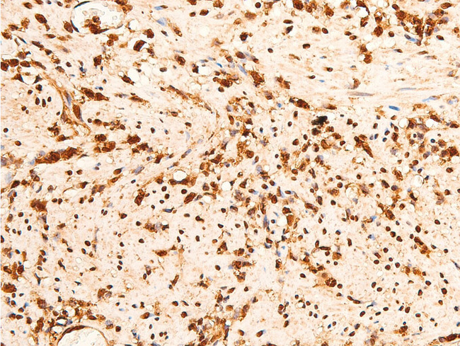 CHEK2 / CHK2 Antibody - 1:100 staining rat appendix tissue by IHC-P. The tissue was formaldehyde fixed and a heat mediated antigen retrieval step in citrate buffer was performed. The tissue was then blocked and incubated with the antibody for 1.5 hours at 22°C. An HRP conjugated goat anti-rabbit antibody was used as the secondary.