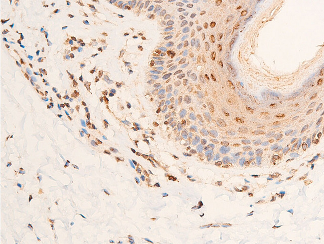 CHEK2 / CHK2 Antibody - 1:100 staining human skin tissue by IHC-P. The tissue was formaldehyde fixed and a heat mediated antigen retrieval step in citrate buffer was performed. The tissue was then blocked and incubated with the antibody for 1.5 hours at 22°C. An HRP conjugated goat anti-rabbit antibody was used as the secondary.
