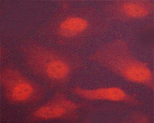 CHEK2 / CHK2 Antibody - Staining HeLa cells by IF/ICC. The samples were fixed with PFA and permeabilized in 0.1% saponin prior to blocking in 10% serum for 45 min at 37°C. The primary antibody was diluted 1/400 and incubated with the sample for 1 hour at 37°C. A Alexa Fluor® 594 conjugated goat polyclonal to rabbit IgG (H+L), diluted 1/600 was used as secondary antibody.