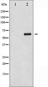 CHEK2 / CHK2 Antibody - Western blot analysis of Chk2 phosphorylation expression in UV treated COS7 whole cells lysates. The lane on the left is treated with the antigen-specific peptide.