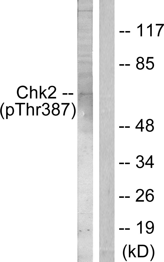 CHEK2 / CHK2 Antibody - Western blot analysis of lysates from Jurkat cells, using Chk2 (Phospho-Thr387) Antibody. The lane on the right is blocked with the phospho peptide.