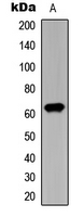 CHEK2 / CHK2 Antibody - Western blot analysis of CHK2 (pT387) expression in HeLa (A) whole cell lysates.