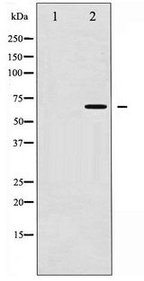 CHEK2 / CHK2 Antibody - Western blot of Chk2 phosphorylation expression in Jurkat whole cell lysates,The lane on the left is treated with the antigen-specific peptide.