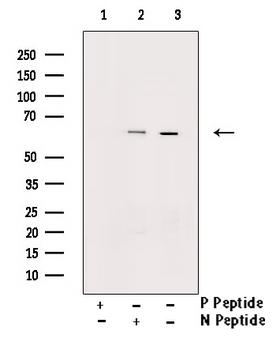 CHEK2 / CHK2 Antibody - Western blot analysis of Chk2 phosphorylation expression in HeLa whole cells lysates. The lane on the right is treated with the antigen-specific peptide.