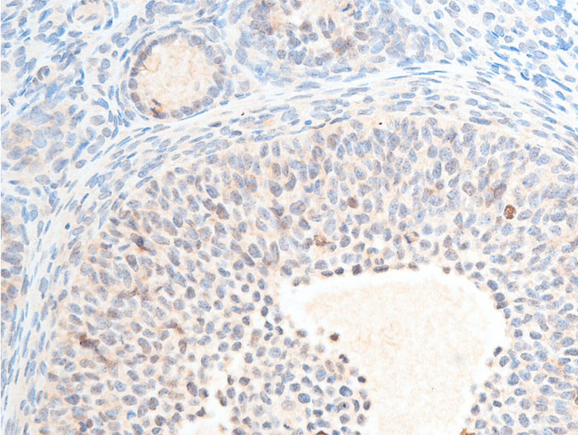 CHEK2 / CHK2 Antibody - 1:100 staining rat ovarian tissue by IHC-P. The tissue was formaldehyde fixed and a heat mediated antigen retrieval step in citrate buffer was performed. The tissue was then blocked and incubated with the antibody for 1.5 hours at 22°C. An HRP conjugated goat anti-rabbit antibody was used as the secondary.