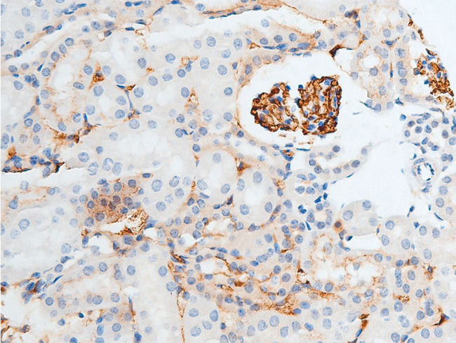 CHEK2 / CHK2 Antibody - 1:100 staining mouse kidney tissue by IHC-P. The tissue was formaldehyde fixed and a heat mediated antigen retrieval step in citrate buffer was performed. The tissue was then blocked and incubated with the antibody for 1.5 hours at 22°C. An HRP conjugated goat anti-rabbit antibody was used as the secondary.