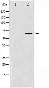 CHEK2 / CHK2 Antibody - Western blot analysis of Chk2 phosphorylation expression in Jurkat whole cells lysates. The lane on the left is treated with the antigen-specific peptide.