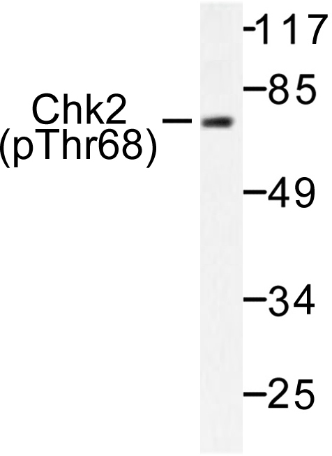 CHEK2 / CHK2 Antibody - Western blot of p-Chk2 (T68) pAb in extracts from NIH/3T3 cells treated with UV.