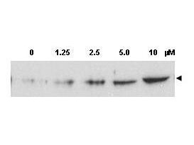 CHEK2 / CHK2 Antibody - Anti-Chk2 pT68 Antibody - Western Blot. Western blot of Affinity Purified anti-Chk2 pT68 antibody shows detection of a predominant band at ~60 kD corresponding to phosphorylated Chk2 (arrowhead) in MCF-7 whole cell lysates after treatment with doxorubicin. Chk2 phosphorylation was induced using increasing concentrations of the DNA damaging agent doxorubicin as indicated for 24 h prior to lysate production. Personal communication, Xiao HeYang, University of Oklahoma Health Sciences Center.