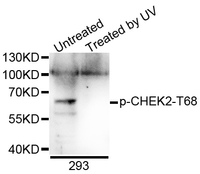 CHEK2 / CHK2 Antibody - Western blot analysis of extracts of 293 cells.