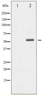 CHEK2 / CHK2 Antibody - Western blot of Chk2 phosphorylation expression in UV treated Jurkat whole cell lysates,The lane on the left is treated with the antigen-specific peptide.