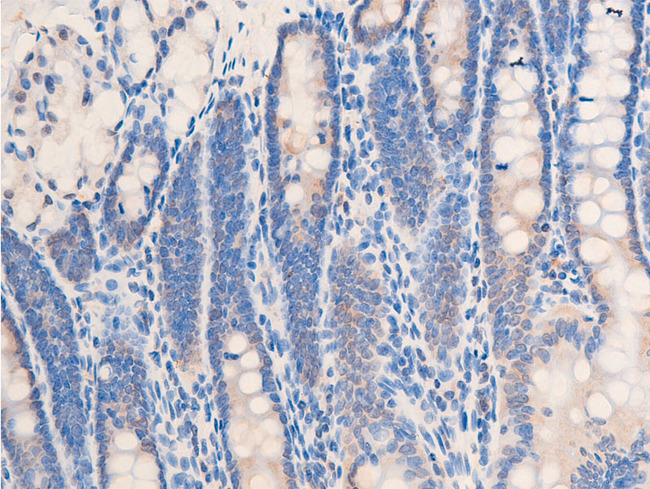 CHEK2 / CHK2 Antibody - 1:100 staining rat colon tissue by IHC-P. The tissue was formaldehyde fixed and a heat mediated antigen retrieval step in citrate buffer was performed. The tissue was then blocked and incubated with the antibody for 1.5 hours at 22°C. An HRP conjugated goat anti-rabbit antibody was used as the secondary.