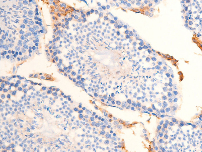 CHEK2 / CHK2 Antibody - 1:100 staining mouse testis tissue by IHC-P. The tissue was formaldehyde fixed and a heat mediated antigen retrieval step in citrate buffer was performed. The tissue was then blocked and incubated with the antibody for 1.5 hours at 22°C. An HRP conjugated goat anti-rabbit antibody was used as the secondary.