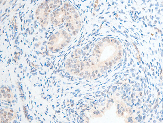 CHEK2 / CHK2 Antibody - 1:100 staining rat uterine tissue by IHC-P. The tissue was formaldehyde fixed and a heat mediated antigen retrieval step in citrate buffer was performed. The tissue was then blocked and incubated with the antibody for 1.5 hours at 22°C. An HRP conjugated goat anti-rabbit antibody was used as the secondary.