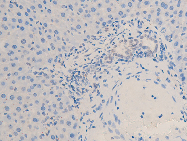 CHEK2 / CHK2 Antibody - 1:100 staining rat liver tissue by IHC-P. The tissue was formaldehyde fixed and a heat mediated antigen retrieval step in citrate buffer was performed. The tissue was then blocked and incubated with the antibody for 1.5 hours at 22°C. An HRP conjugated goat anti-rabbit antibody was used as the secondary.