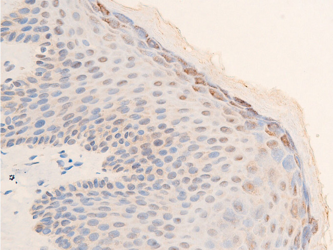 CHEK2 / CHK2 Antibody - 1:100 staining human skin tissue by IHC-P. The tissue was formaldehyde fixed and a heat mediated antigen retrieval step in citrate buffer was performed. The tissue was then blocked and incubated with the antibody for 1.5 hours at 22°C. An HRP conjugated goat anti-rabbit antibody was used as the secondary.