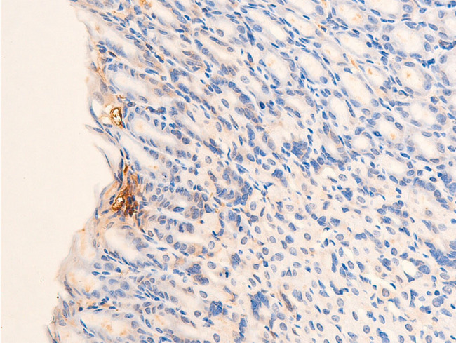 CHEK2 / CHK2 Antibody - 1:100 staining mouse gastric tissue by IHC-P. The tissue was formaldehyde fixed and a heat mediated antigen retrieval step in citrate buffer was performed. The tissue was then blocked and incubated with the antibody for 1.5 hours at 22°C. An HRP conjugated goat anti-rabbit antibody was used as the secondary.
