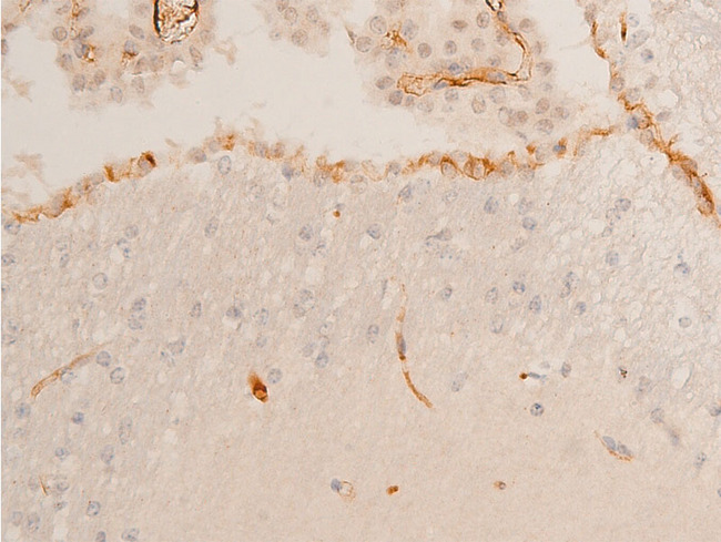 CHEK2 / CHK2 Antibody - 1:100 staining mouse brain tissue by IHC-P. The tissue was formaldehyde fixed and a heat mediated antigen retrieval step in citrate buffer was performed. The tissue was then blocked and incubated with the antibody for 1.5 hours at 22°C. An HRP conjugated goat anti-rabbit antibody was used as the secondary.
