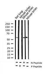 CHEK2 / CHK2 Antibody - Western blot analysis of Phospho-Chk2 (Thr68) expression in various lysates