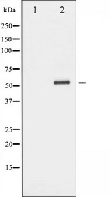 CHEK2 / CHK2 Antibody - Western blot analysis of Chk2 phosphorylation expression in UV treated Jurkat whole cells lysates. The lane on the left is treated with the antigen-specific peptide.
