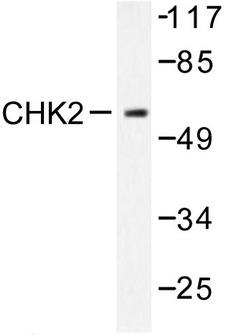 CHEK2 / CHK2 Antibody - Western blot of Chk2 (S379) pAb in extracts from COS7 cells treated with UV 30'.