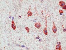CHEMR23 / CMKLR1 Antibody - Clone 1A5 swine brain cortex, paraffin section