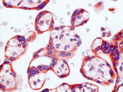 CHEMR23 / CMKLR1 Antibody - Clone 1A7 human placenta, paraffin section