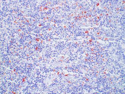 CHEMR23 / CMKLR1 Antibody - Clone 1610 mouse spleen, paraffin section