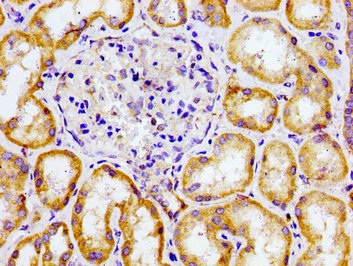 CHEMR23 / CMKLR1 Antibody - Immunohistochemistry image of paraffin-embedded human kidney tissue at a dilution of 1:100
