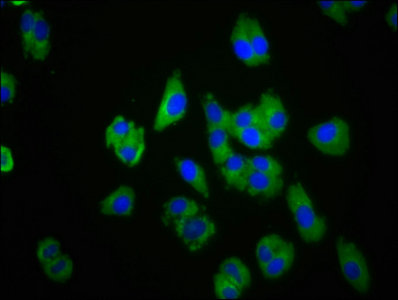 CHEMR23 / CMKLR1 Antibody - Immunofluorescence staining of HepG2 cells with CMKLR1 Antibody at 1:100, counter-stained with DAPI. The cells were fixed in 4% formaldehyde, permeabilized using 0.2% Triton X-100 and blocked in 10% normal Goat Serum. The cells were then incubated with the antibody overnight at 4°C. The secondary antibody was Alexa Fluor 488-congugated AffiniPure Goat Anti-Rabbit IgG(H+L).