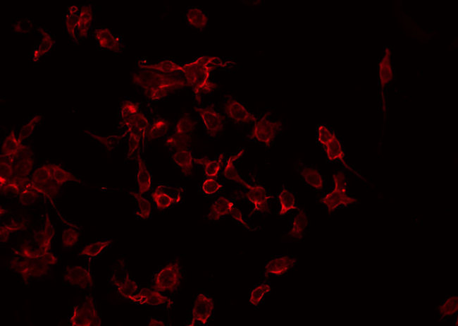 CHEMR23 / CMKLR1 Antibody - Staining HeLa cells by IF/ICC. The samples were fixed with PFA and permeabilized in 0.1% Triton X-100, then blocked in 10% serum for 45 min at 25°C. The primary antibody was diluted at 1:200 and incubated with the sample for 1 hour at 37°C. An Alexa Fluor 594 conjugated goat anti-rabbit IgG (H+L) Ab, diluted at 1/600, was used as the secondary antibody.
