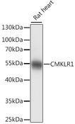 CHEMR23 / CMKLR1 Antibody - Western blot analysis of extracts of rat heart using CMKLR1 Polyclonal Antibody at dilution of 1:1000.