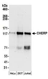 CHERP Antibody - Detection of human CHERP by western blot. Samples: Whole cell lysate (50 µg) from HeLa, HEK293T, and Jurkat cells prepared using NETN lysis buffer. Antibodies: Affinity purified rabbit anti-CHERP antibody used for WB at 0.1 µg/ml. Detection: Chemiluminescence with an exposure time of 30 seconds.