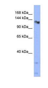 CHERP Antibody - CHERP antibody Western blot of HT1080 cell lysate. This image was taken for the unconjugated form of this product. Other forms have not been tested.