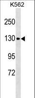 CHERP Antibody - CHERP Antibody western blot of K562 cell line lysates (35 ug/lane). The CHERP antibody detected the CHERP protein (arrow).