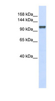 CHERP Antibody - CHERP antibody Western blot of 293T cell lysate. This image was taken for the unconjugated form of this product. Other forms have not been tested.