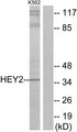 CHF1 / HEY2 Antibody - Western blot analysis of lysates from K562 cells, using HEY2 Antibody. The lane on the right is blocked with the synthesized peptide.