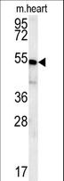 CHF1 / HEY2 Antibody - HEY2 Antibody western blot of mouse heart tissue lysates (15 ug/lane). The HEY2 antibody detected HEY2 protein (arrow).