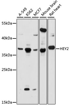 CHF1 / HEY2 Antibody - Western blot analysis of extracts of various cell lines, using HEY2 antibody at 1:1000 dilution. The secondary antibody used was an HRP Goat Anti-Rabbit IgG (H+L) at 1:10000 dilution. Lysates were loaded 25ug per lane and 3% nonfat dry milk in TBST was used for blocking. An ECL Kit was used for detection and the exposure time was 60s.