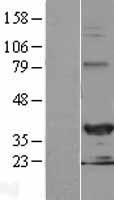 CHF1 / HEY2 Protein - Western validation with an anti-DDK antibody * L: Control HEK293 lysate R: Over-expression lysate