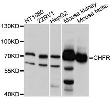 CHFR Antibody - Western blot analysis of extracts of various cell lines, using CHFR antibody at 1:1000 dilution. The secondary antibody used was an HRP Goat Anti-Rabbit IgG (H+L) at 1:10000 dilution. Lysates were loaded 25ug per lane and 3% nonfat dry milk in TBST was used for blocking. An ECL Kit was used for detection and the exposure time was 5s.