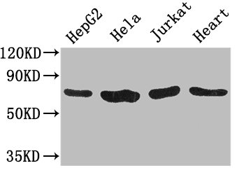 CHFR Antibody - Positive WB detected in:HepG2 whole cell lysate,Hela whole cell lysate,Jurkat whole cell lysate,Mouse heart tissue;All lanes: CHFR antibody at 3.2ug/ml;Secondary;Goat polyclonal to rabbit IgG at 1/50000000 dilution;Predicted band size: 74,73,70,64 kDa;Observed band size: 74 kDa;
