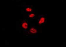 CHFR Antibody - Staining HeLa cells by IF/ICC. The samples were fixed with PFA and permeabilized in 0.1% Triton X-100, then blocked in 10% serum for 45 min at 25°C. The primary antibody was diluted at 1:200 and incubated with the sample for 1 hour at 37°C. An Alexa Fluor 594 conjugated goat anti-rabbit IgG (H+L) Ab, diluted at 1/600, was used as the secondary antibody.