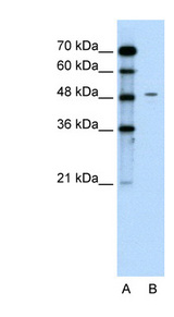 CHGA / Chromogranin A Antibody - CHGA / Chromogranin A antibody Western blot of Jurkat lysate. This image was taken for the unconjugated form of this product. Other forms have not been tested.
