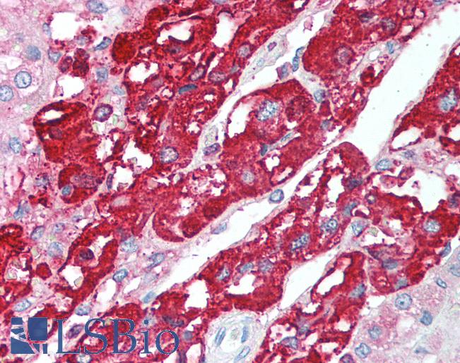 CHGA / Chromogranin A Antibody - Anti-CHGA / Chromogranin A antibody IHC of human adrenal. Immunohistochemistry of formalin-fixed, paraffin-embedded tissue after heat-induced antigen retrieval. Antibody concentration 5 ug/ml.  This image was taken for the unconjugated form of this product. Other forms have not been tested.